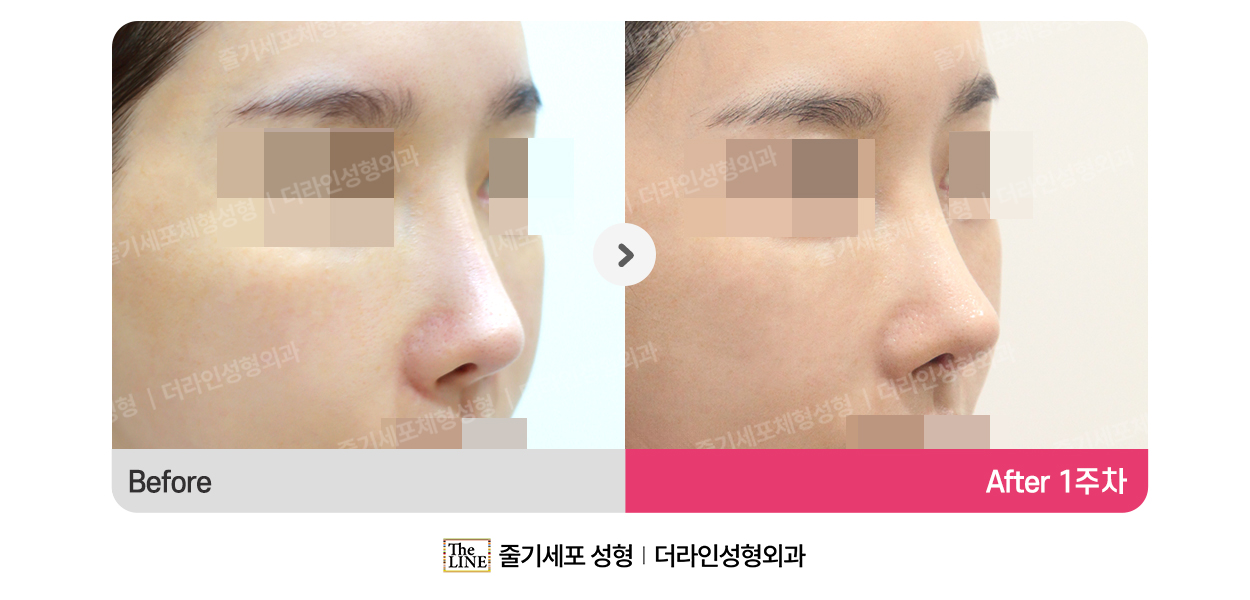코성형 (통합) 대표 이미지