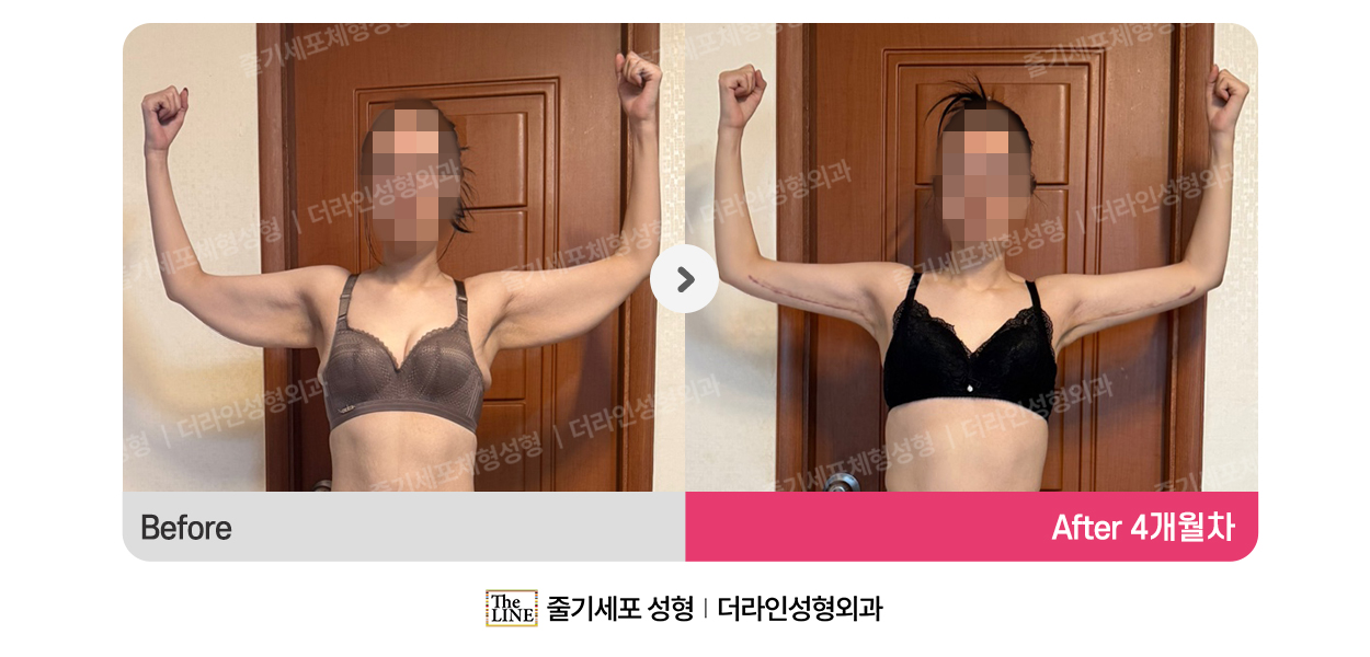 더라인성형외과 시술 상세 이미지