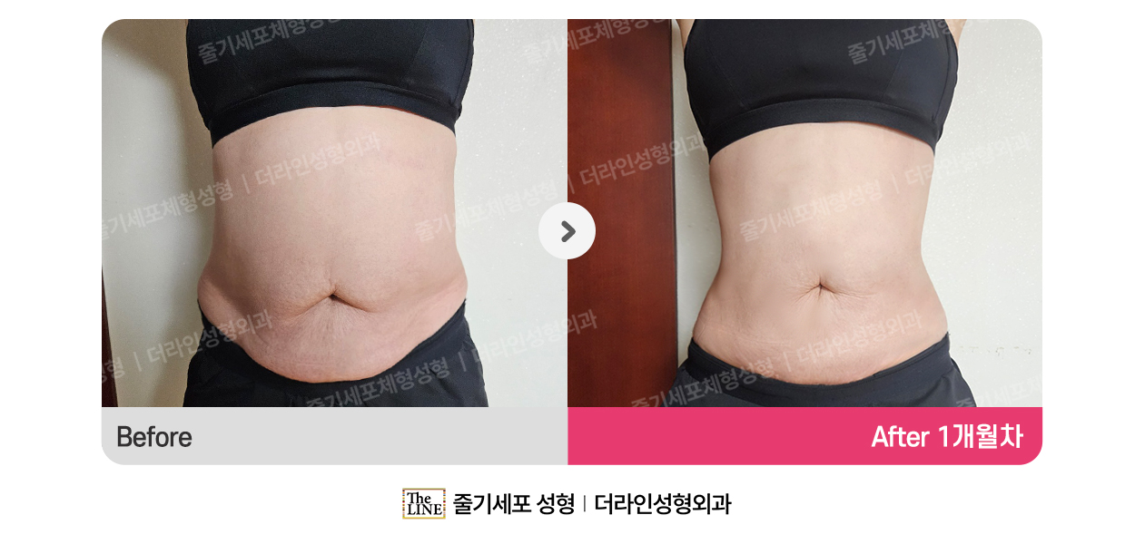 바디거상 대표 이미지