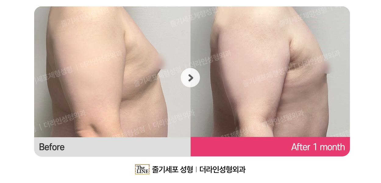 더라인성형외과 시술 상세 이미지
