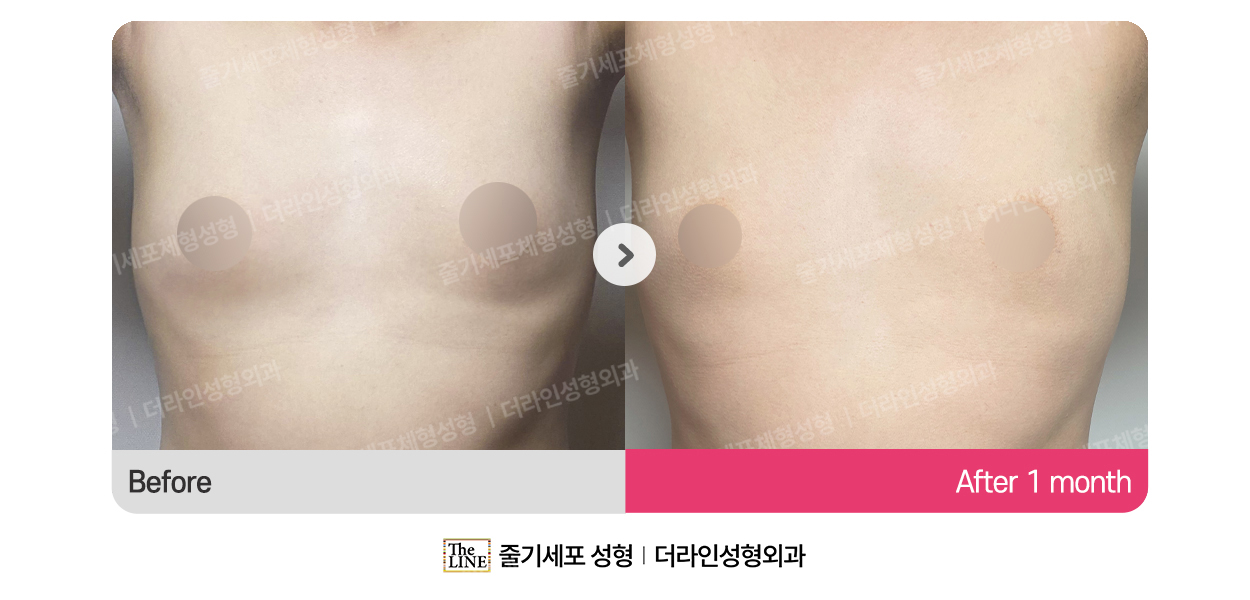 더라인성형외과 시술 상세 이미지